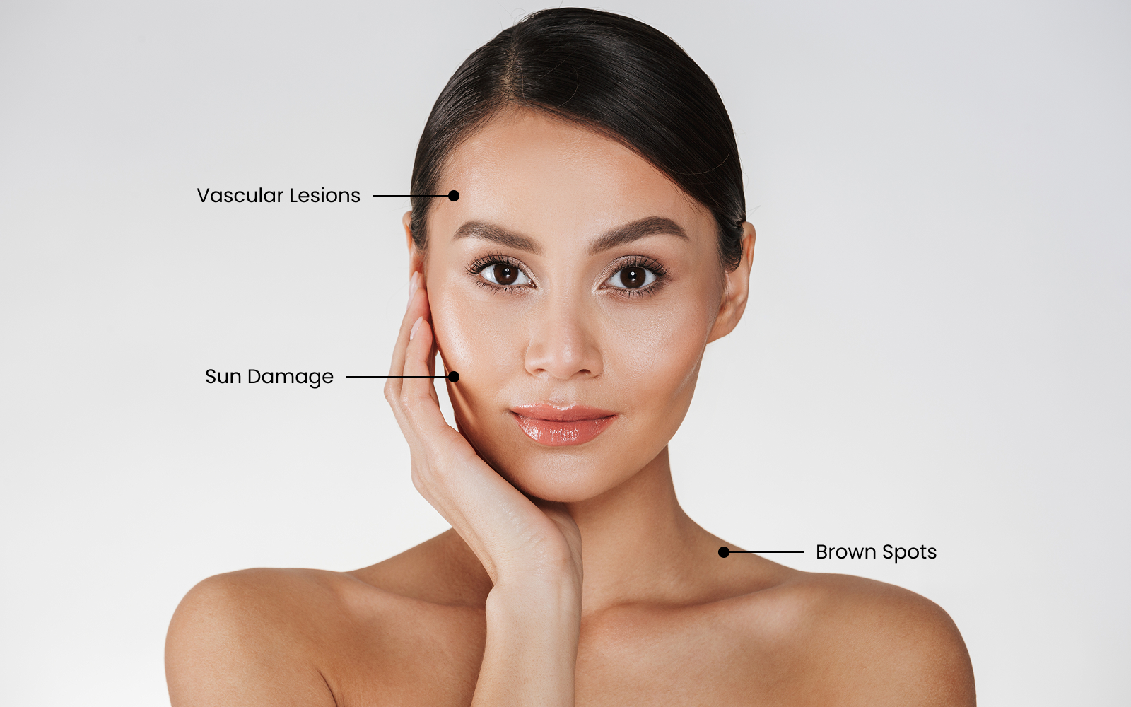 Advanced Skin Treatments at West Spa: Laser Genesis & IPL Lumecca