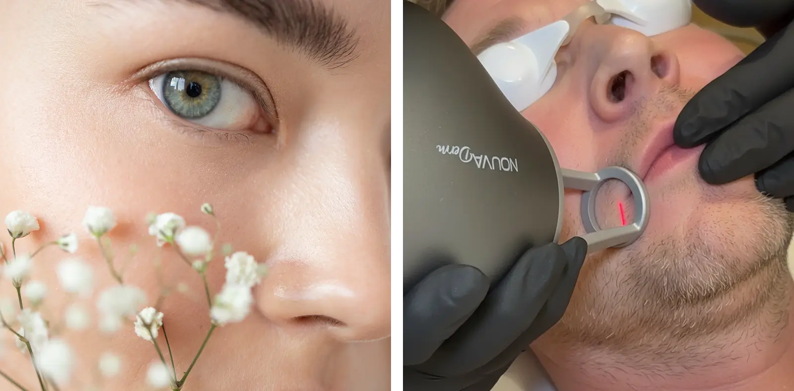 Professional performing Platelet-Rich Plasma (PRP) injections for hair restoration at West Spa Medical Aesthetics DDO.